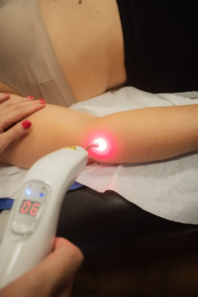 Aplicação de laserterapia